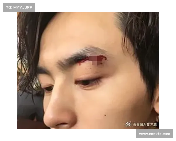 黄俊霞眉骨受伤仍坚持战南非:无畏坚韧,为国争光 黄俊霞眉骨受伤仍坚持战南非:无畏坚韧,为国争光